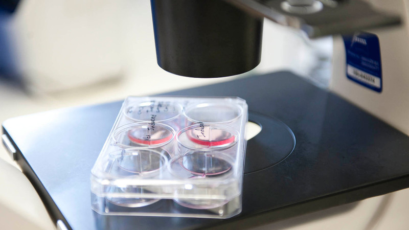 Stem Cell Research Outstrips Legislation