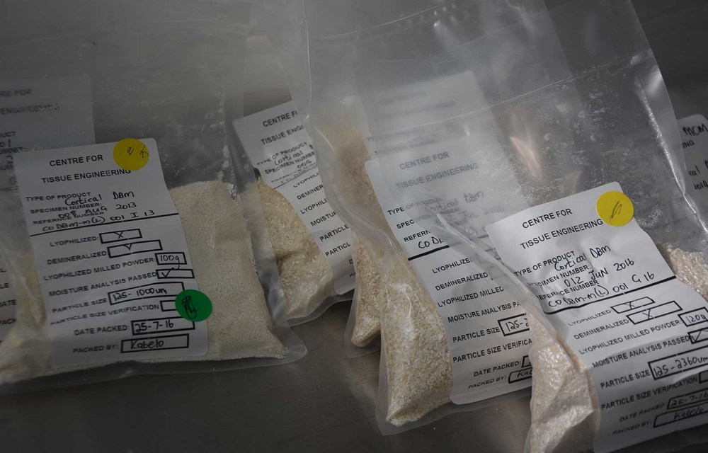 Donated bone from the CTE was used to help these patients.