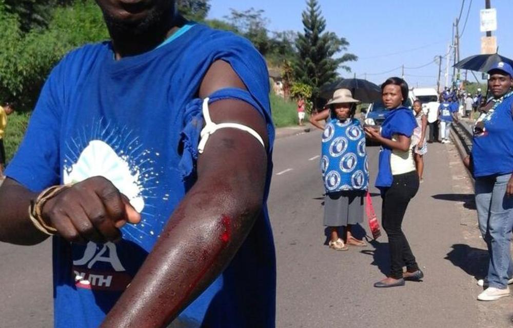 A Democratic Alliance member shows the wound he sustained in altercations with ANC supporters after the DA held a rally in the Welbedacht area of Chatsworth