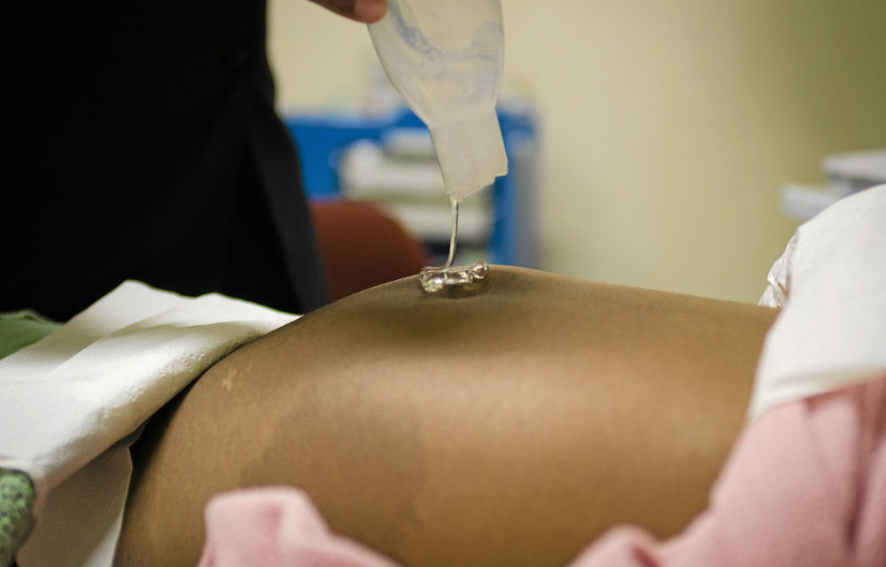 Midwife Miriam Mathose conducts an ultrasound on a pregnant woman.