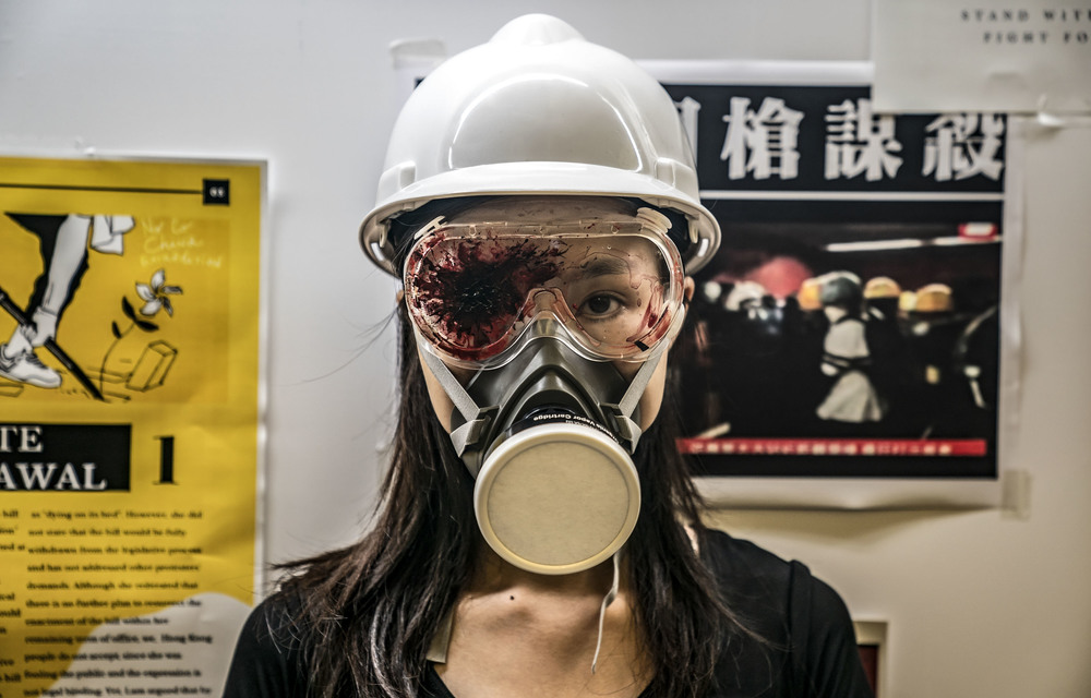 Chilling tribute: A protester wears an eye patch to honour another protester who was shot in the eye during a demonstration. Police in several countries have been criticised for using controversial ammunition.