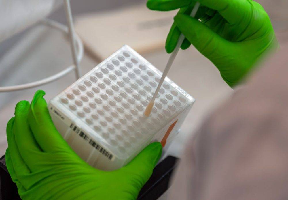 Dkms Laboratory In Dresden
